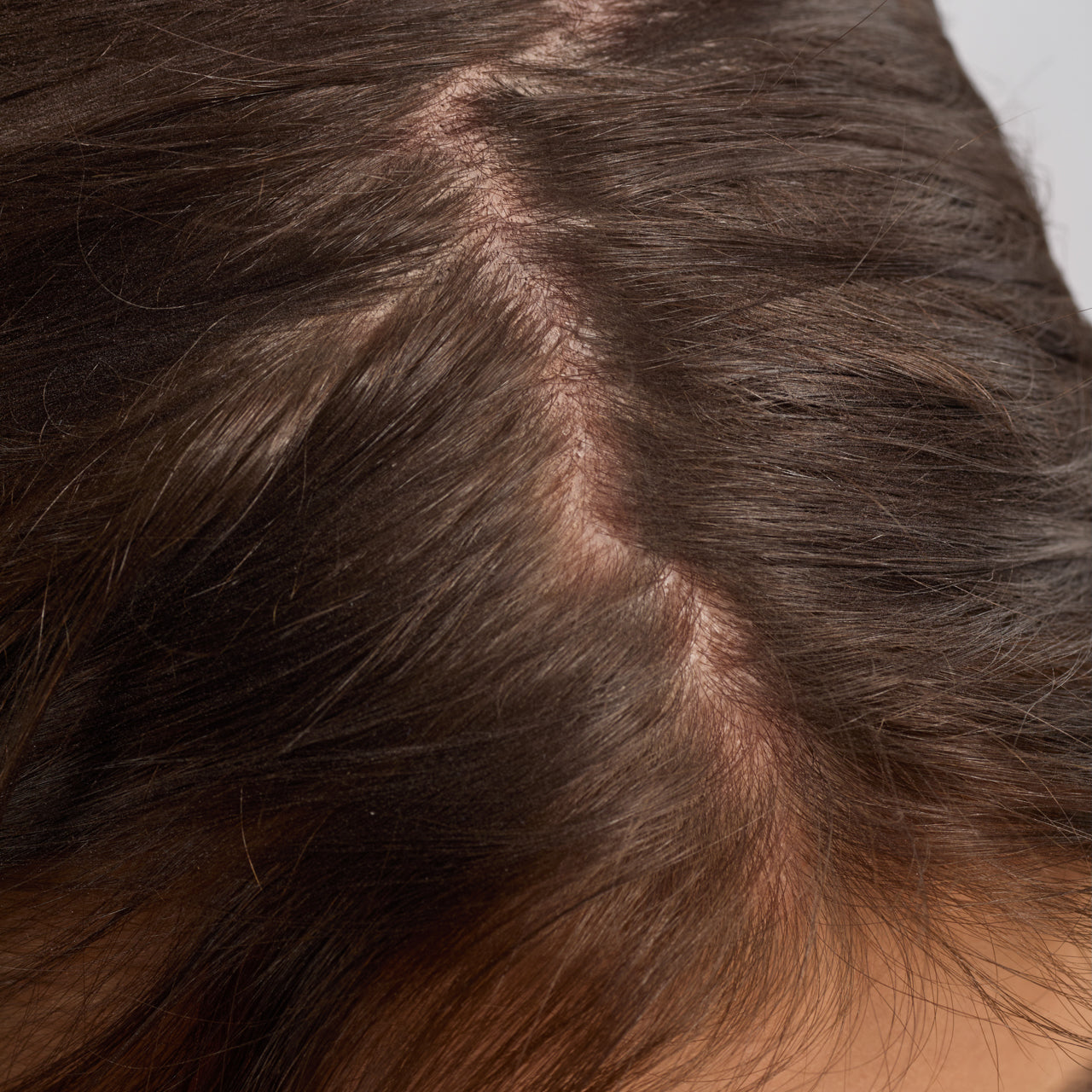 زيت روزماري لتقوية الشعر وفروة الرأس مع البيوتين 3 عبوات